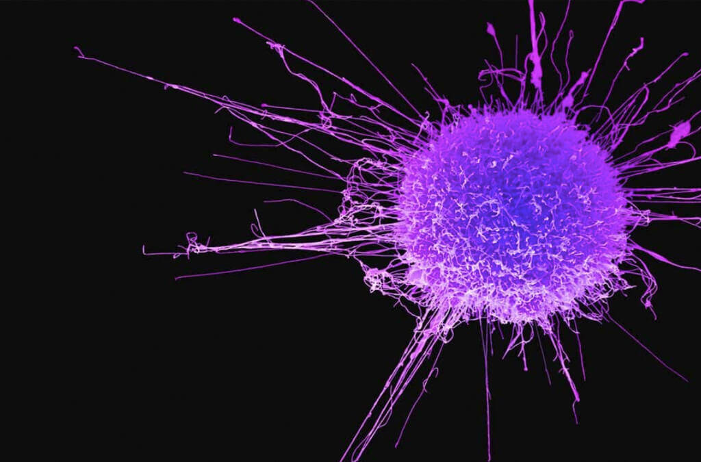 cancer cell